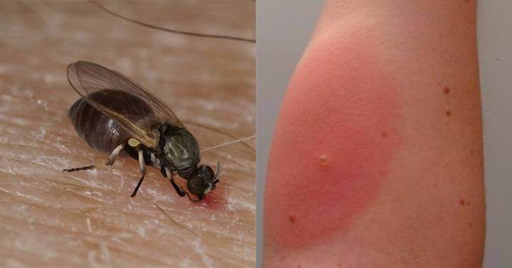 Come riconoscere le punture di insetti per curarsi bene 